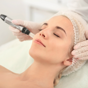 MICRONEEDLING TRAINING